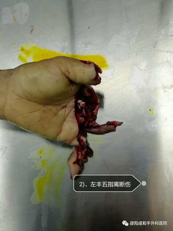 邵陽創(chuàng)傷骨科,邵陽風濕病區(qū),邵陽骨質(zhì)增生,邵陽關(guān)節(jié)病區(qū),邵陽頸椎病區(qū)