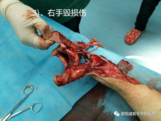 邵陽創(chuàng)傷骨科,邵陽風濕病區(qū),邵陽骨質(zhì)增生,邵陽關(guān)節(jié)病區(qū),邵陽頸椎病區(qū)