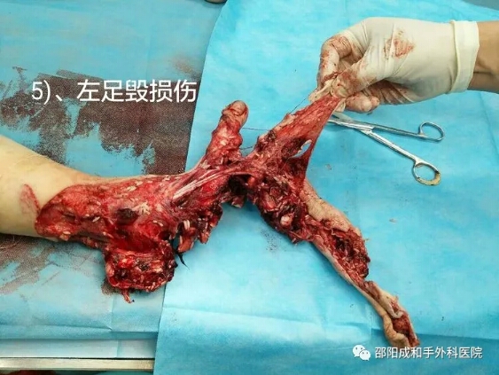 邵陽創(chuàng)傷骨科,邵陽風濕病區(qū),邵陽骨質(zhì)增生,邵陽關(guān)節(jié)病區(qū),邵陽頸椎病區(qū)