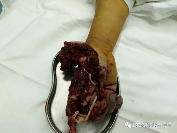 邵陽創(chuàng)傷骨科,邵陽風濕病區(qū),邵陽骨質(zhì)增生,邵陽關(guān)節(jié)病區(qū),邵陽頸椎病區(qū)