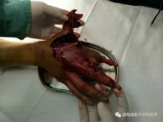 邵陽創(chuàng)傷骨科,邵陽風濕病區(qū),邵陽骨質(zhì)增生,邵陽關(guān)節(jié)病區(qū),邵陽頸椎病區(qū)