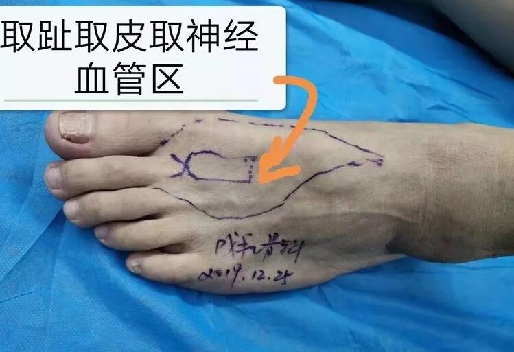 邵陽創(chuàng)傷骨科,邵陽風濕病區(qū),邵陽骨質(zhì)增生,邵陽關節(jié)病區(qū),邵陽頸椎病區(qū)