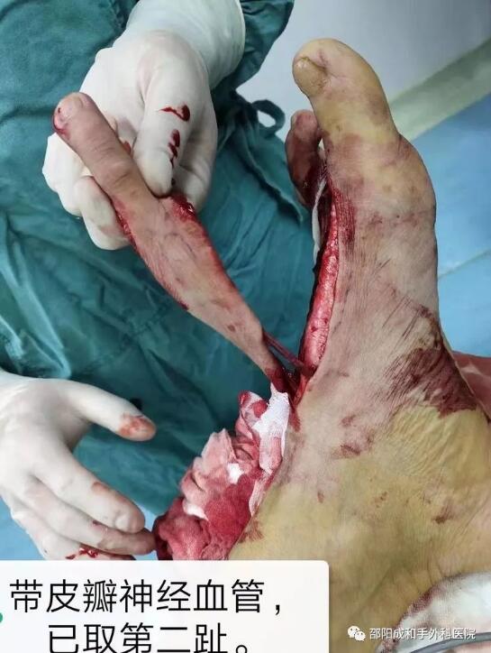 邵陽創(chuàng)傷骨科,邵陽風濕病區(qū),邵陽骨質(zhì)增生,邵陽關節(jié)病區(qū),邵陽頸椎病區(qū)