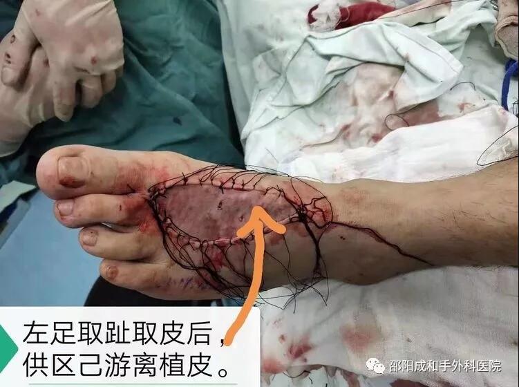 邵陽創(chuàng)傷骨科,邵陽風濕病區(qū),邵陽骨質(zhì)增生,邵陽關節(jié)病區(qū),邵陽頸椎病區(qū)