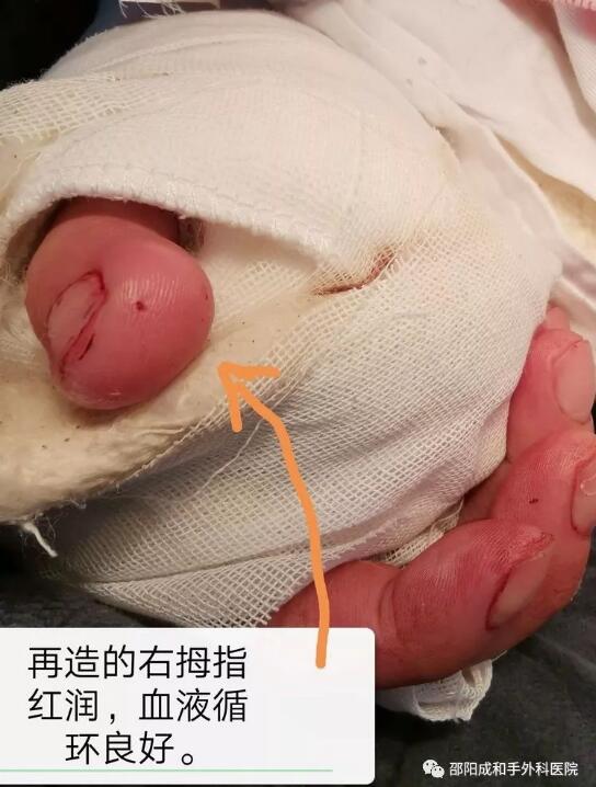 邵陽創(chuàng)傷骨科,邵陽風濕病區(qū),邵陽骨質(zhì)增生,邵陽關節(jié)病區(qū),邵陽頸椎病區(qū)