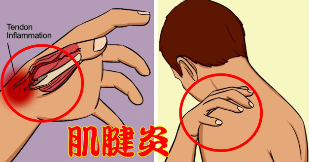 邵陽(yáng)創(chuàng)傷骨科,邵陽(yáng)風(fēng)濕病區(qū),邵陽(yáng)骨質(zhì)增生,邵陽(yáng)關(guān)節(jié)病區(qū),邵陽(yáng)頸椎病區(qū) 邵陽(yáng)創(chuàng)傷骨科,邵陽(yáng)風(fēng)濕病區(qū),邵陽(yáng)骨質(zhì)增生,邵陽(yáng)關(guān)節(jié)病區(qū),邵陽(yáng)頸椎病區(qū)