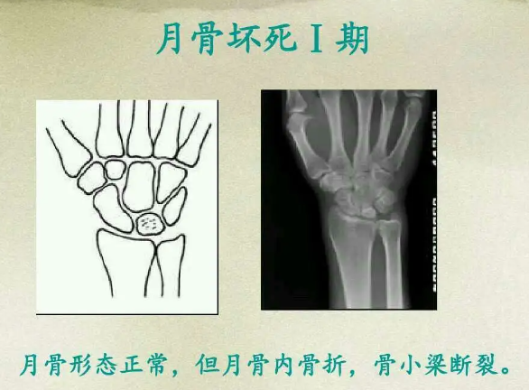 邵陽創(chuàng)傷骨科,邵陽風濕病區(qū),邵陽骨質增生,邵陽關節(jié)病區(qū),邵陽頸椎病區(qū)