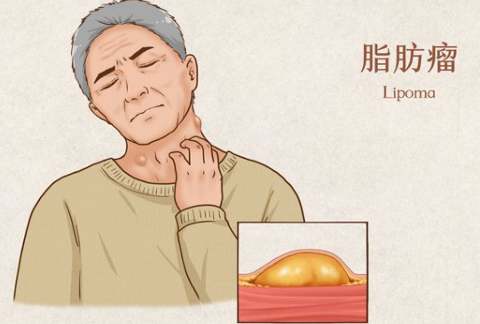 邵陽創(chuàng)傷骨科,邵陽風濕病區(qū),邵陽骨質(zhì)增生,邵陽關(guān)節(jié)病區(qū),邵陽頸椎病區(qū)