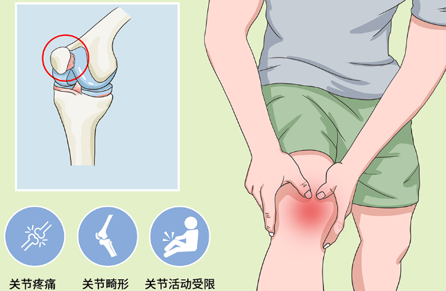 邵陽創(chuàng)傷骨科,邵陽風濕病區(qū),邵陽骨質增生,邵陽關節(jié)病區(qū),邵陽頸椎病區(qū)